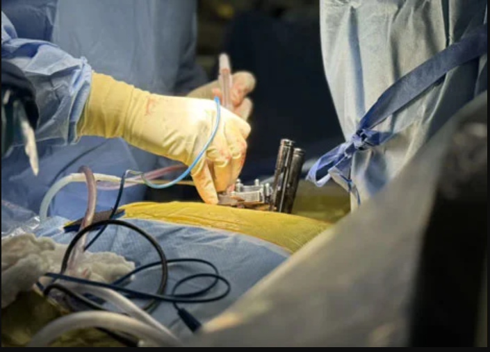 Modern Spine Care: Why Minimally Invasive Surgery Is Changing Lives